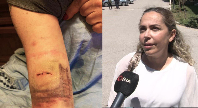 Yürüyüş yapmak isteyen kadına sokak köpekleri dehşeti yaşattı: Canını zor kurtardı görseli
