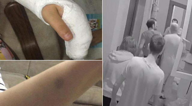 Komşu kavgasını ayırmak isterken darp edildi, hamile eşinin parmakları kırıldı görseli