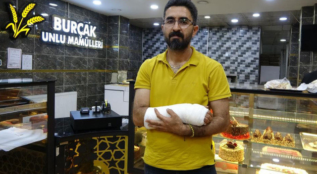 Köpeğin saldırdığı kadına yardım etmek istedi, başına gelmeyen kalmadı görseli