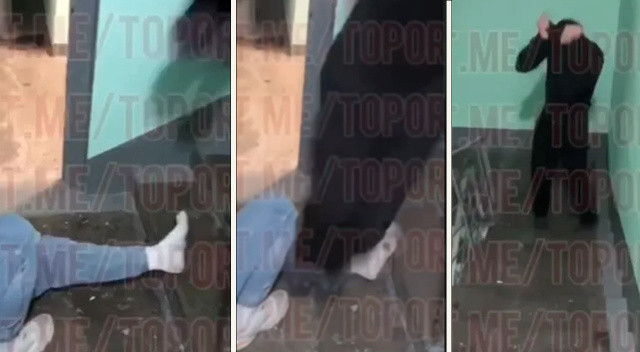 Rusya'da çaresizliğin fotoğrafı! 'Çürük raporu' için bacaklarını kırıyorlar görseli