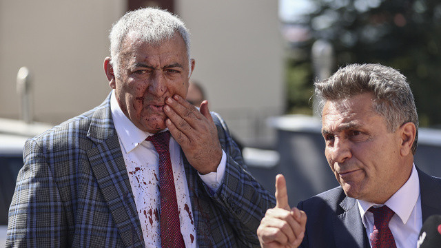 Ümit Özdağ'a şok suçlama: Partideki muhalifleri dövdürttü görseli